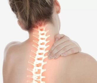 Servikal osteokondroz