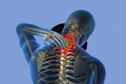 Osteokondroz ile boyunda ağrı