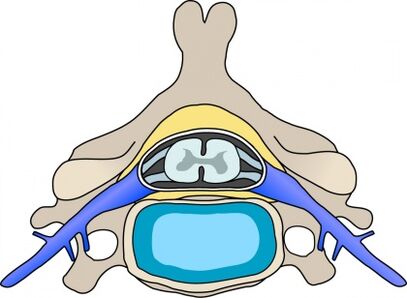 Servikal osteokondrozlu omurda protabius